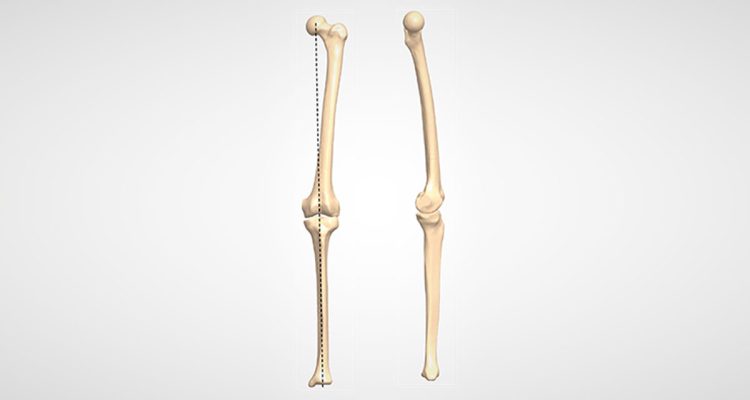 , Basic Considerations of Deformity Correction: Anatomical and Mechanical Axis