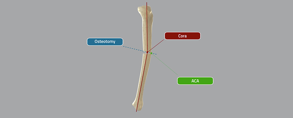 , CORA (Center Of Rotation of Angulation)