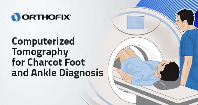 , Computerized Tomography for Charcot Foot and Ankle Diagnosis