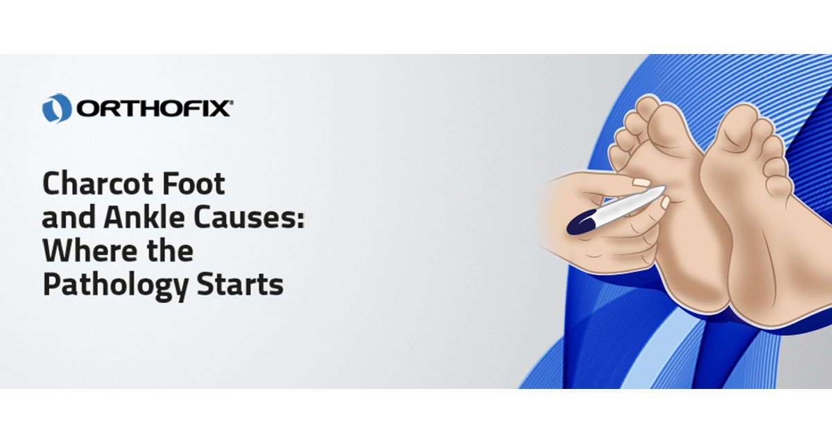 , Charcot Foot and Ankle Causes: Where the Pathology Starts