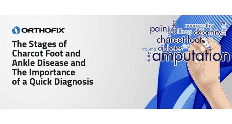 , The Stages of Charcot Foot and Ankle Disease and The Importance of a Quick Diagnosis