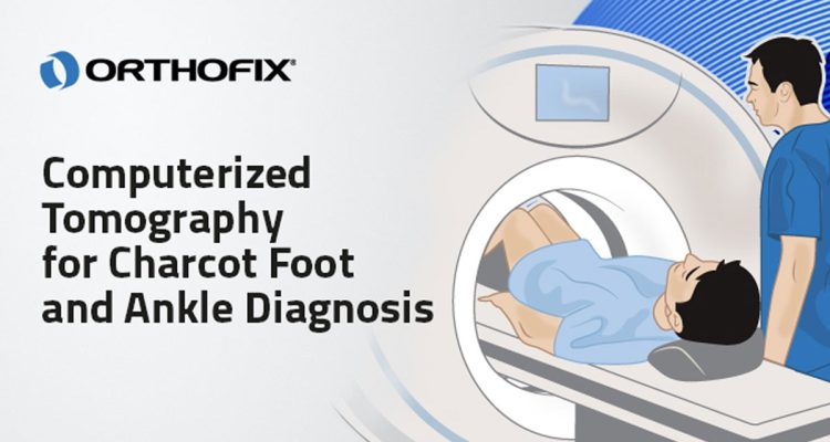 , Computerized Tomography for Charcot Foot and Ankle Diagnosis