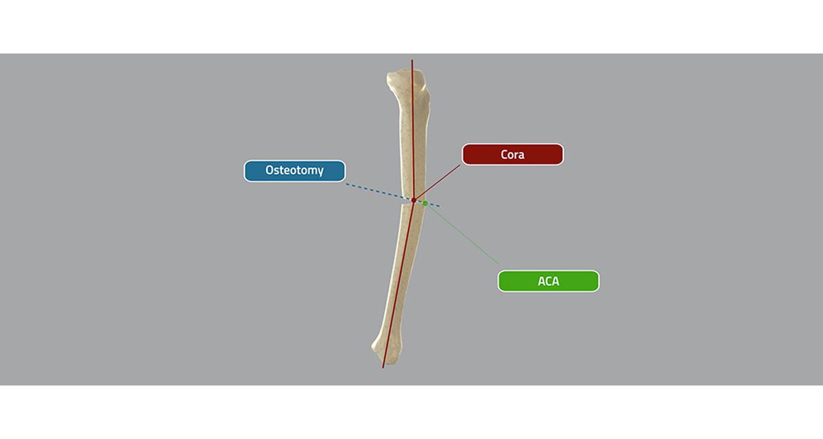 , CORA (Center Of Rotation of Angulation)